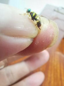 ​果蝇危害你们知道么？