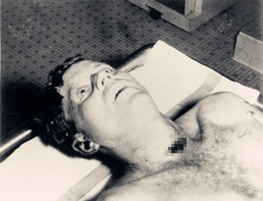 肯尼迪遇刺谜团：图四肯尼迪遗体不闭眼，图八副总统两小时后就职