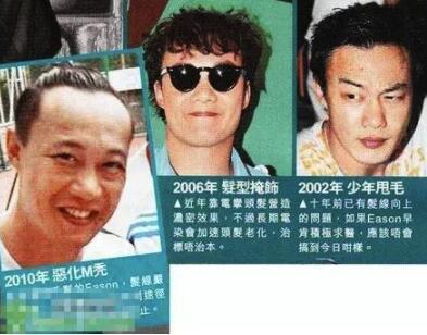 胡歌心形发际线走红，不仅女星脱发，男星的中年除了发福还有秃顶